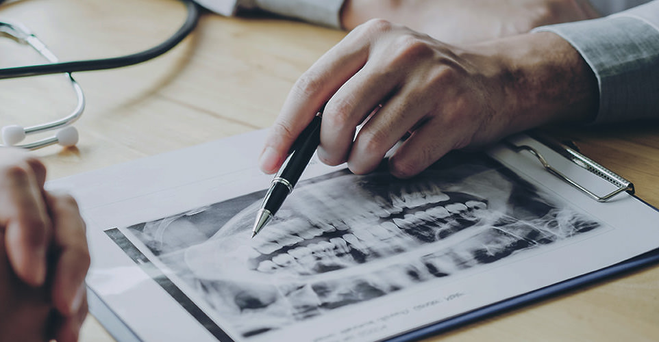 Person pointing to a dental panographic image with a pen